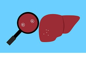 liver disease